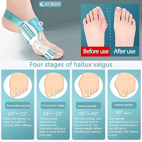 Toe Straightener Bunion Corrector for Women & Men