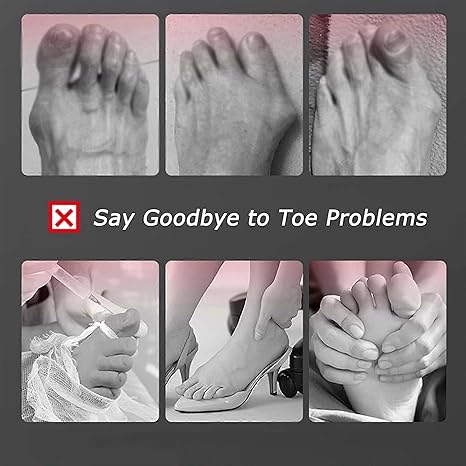 Toe Straightener Bunion Corrector for Women & Men